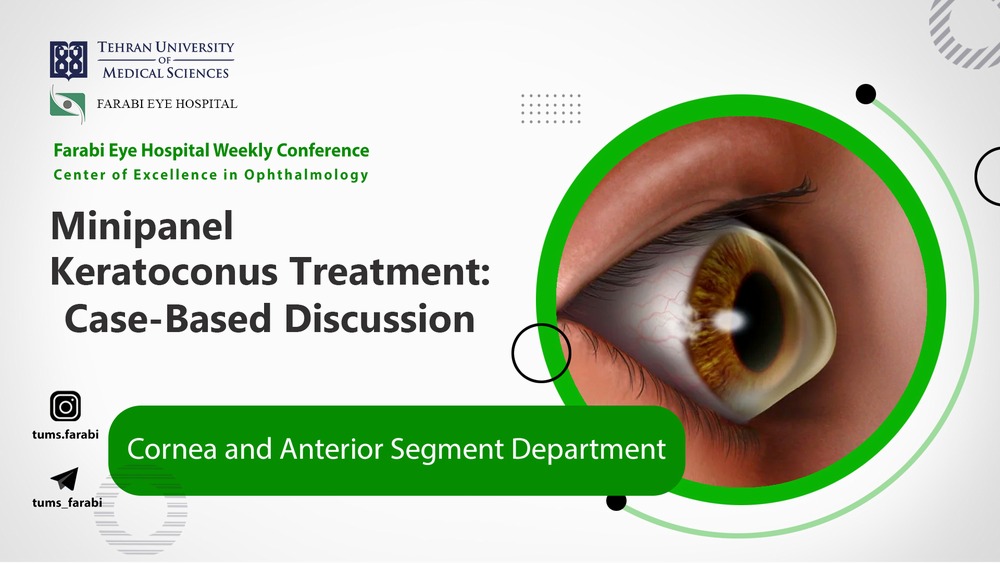 مینی‌پنل گروه قرنیه بیمارستان فارابی؛ درمان کراتوکونوس از لنز تا پیوند